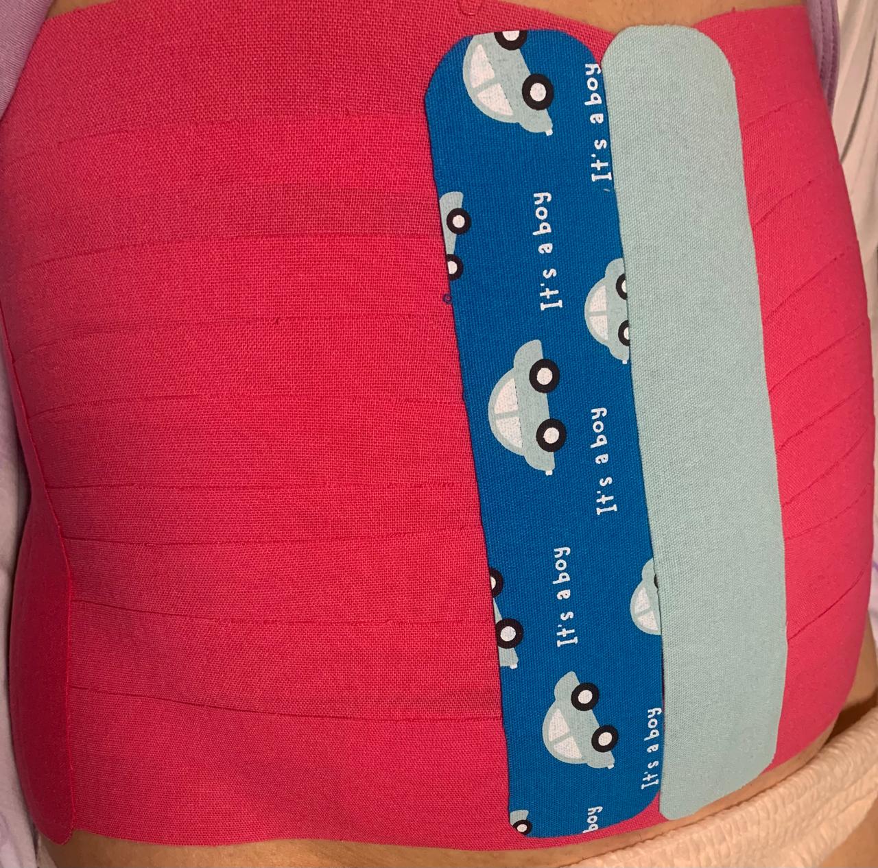 Taping abdominal pós-parto
